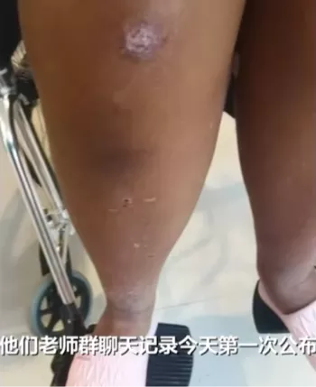 女孩遭体罚身亡